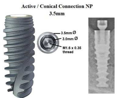 Implant Components by Brand