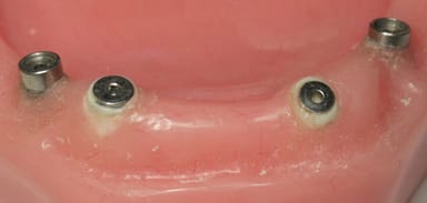 Shiner Magnets
