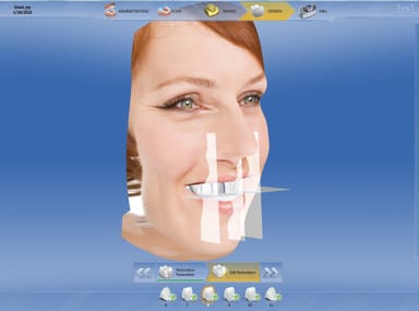 CEREC Software 4.2