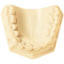 Silky-Rock Low Expansion Die Stone - 55 lb Carton