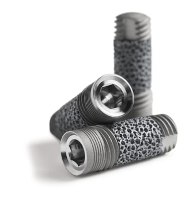 Trabecular Metal Dental Implant